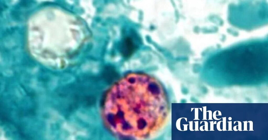 Former top US food safety official says Trump’s handling of cyclospora is ‘catastrophic’ | Trump administration